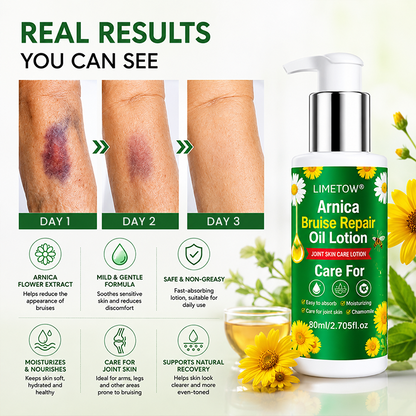 LIMETOW® Arnica Bruise Repair Oil