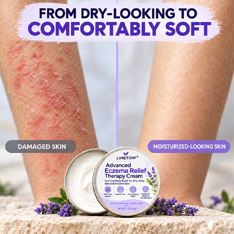 LIMETOW® Advanced Eczema Relief Therapy Cream! Powerful Eczema