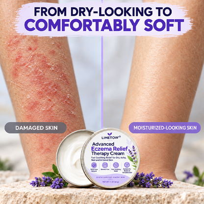 LIMETOW® Advanced Eczema Relief Therapy Cream! Powerful Eczema