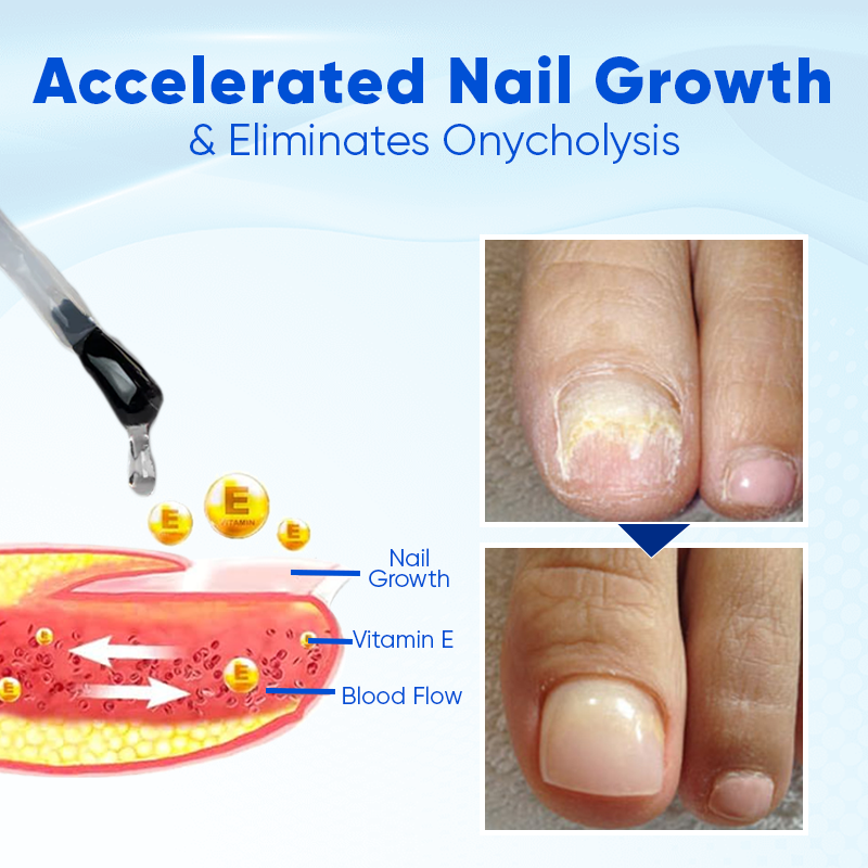 LIMETOW® OnyxoGuard Nail Growth and Repair Serum