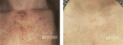 Dark Spot Corrector | Buy More, Save More!