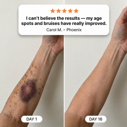 🏆𝐎𝐟𝐟𝐢𝐜𝐢𝐚𝐥 𝐔𝐒 𝐒𝐭𝐨𝐫𝐞🎉Over 100K+ Sold🔥 Dobshow® All-New Upgraded Dark Spot Correcting, Bruise Healing & Skin Strengthening Cream✨