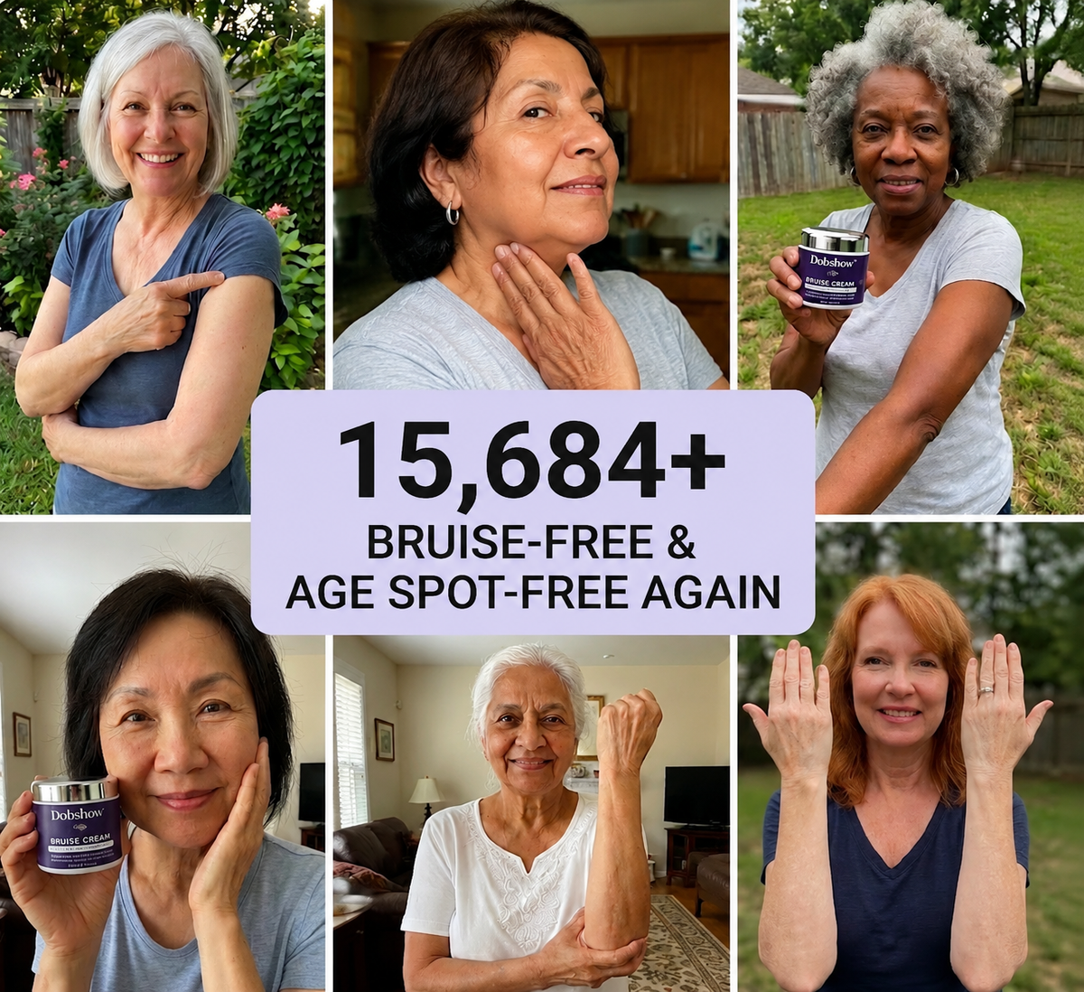 🏆𝐎𝐟𝐟𝐢𝐜𝐢𝐚𝐥 𝐔𝐒 𝐒𝐭𝐨𝐫𝐞🎉Over 100K+ Sold🔥 Dobshow® All-New Upgraded Dark Spot Correcting, Bruise Healing & Skin Strengthening Cream✨