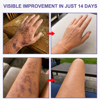 🏆𝐎𝐟𝐟𝐢𝐜𝐢𝐚𝐥 𝐔𝐒 𝐒𝐭𝐨𝐫𝐞🎉Over 100K+ Sold🔥 Dobshow® All-New Upgraded Dark Spot Correcting, Bruise Healing & Skin Strengthening Cream✨