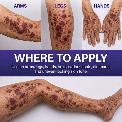🏆𝐎𝐟𝐟𝐢𝐜𝐢𝐚𝐥 𝐔𝐒 𝐒𝐭𝐨𝐫𝐞🎉Over 100K+ Sold🔥 Dobshow® All-New Upgraded Dark Spot Correcting, Bruise Healing & Skin Strengthening Cream✨