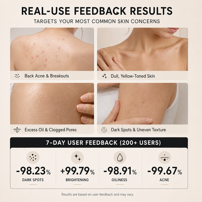 ✨ Niacinamide Skin Soap – Brightens, Fades Spots & Freckles