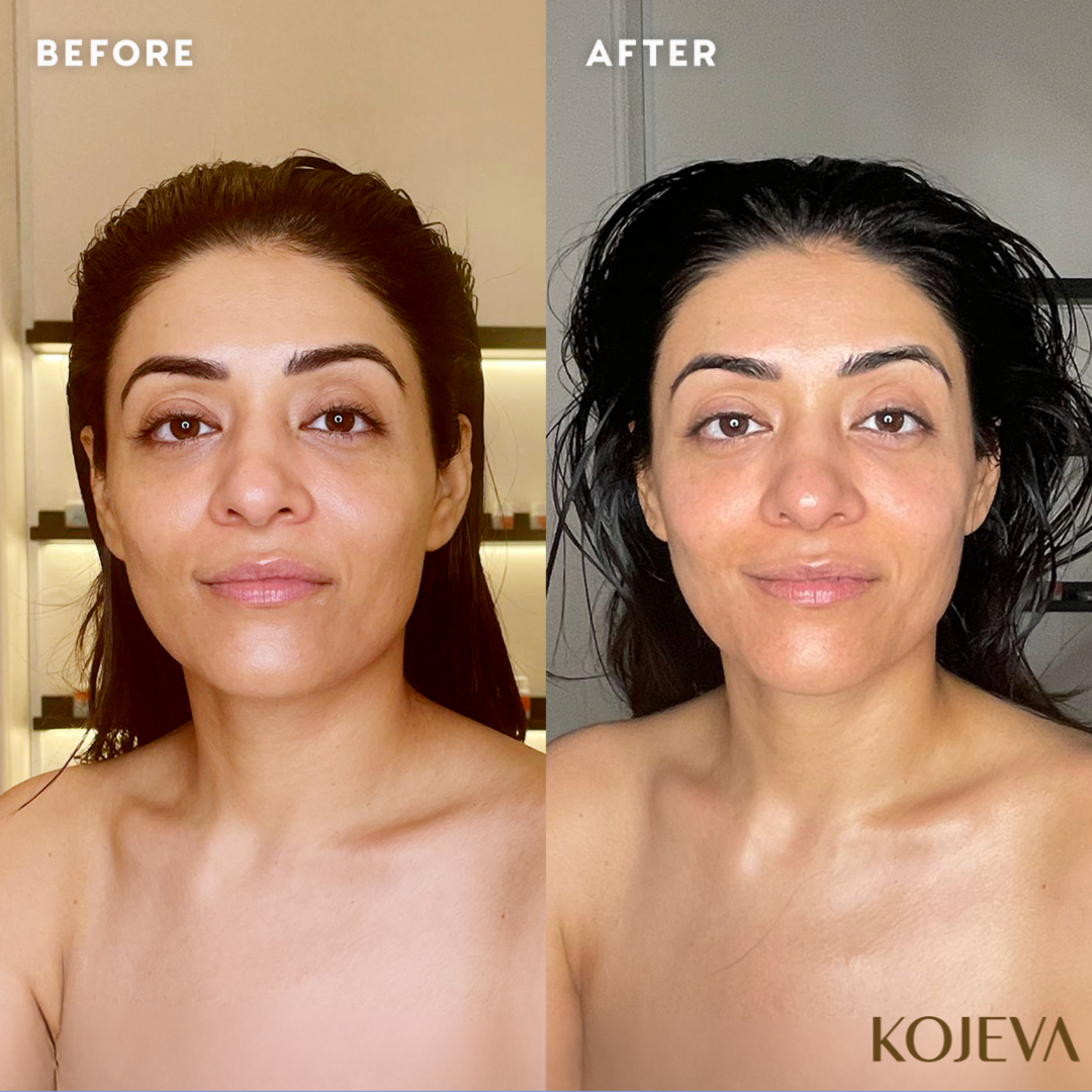 Kojeva Lymphatic Face Brush