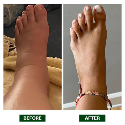 LIMETOW® Arnica Bruise Repair Oil
