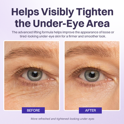 LIMETOW® INSTANT LIFT EYE GEL