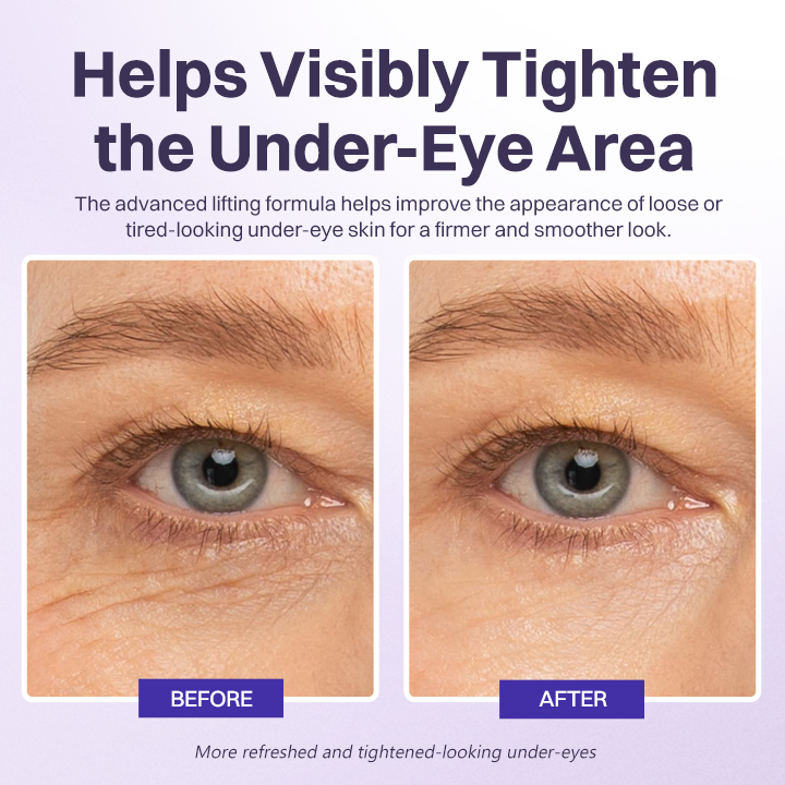LIMETOW® INSTANT LIFT EYE GEL