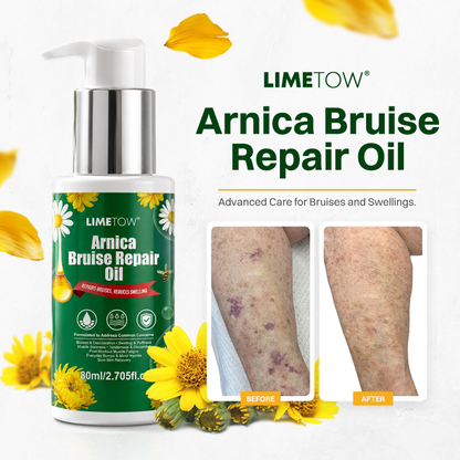LIMETOW® Arnica Bruise Repair Oil