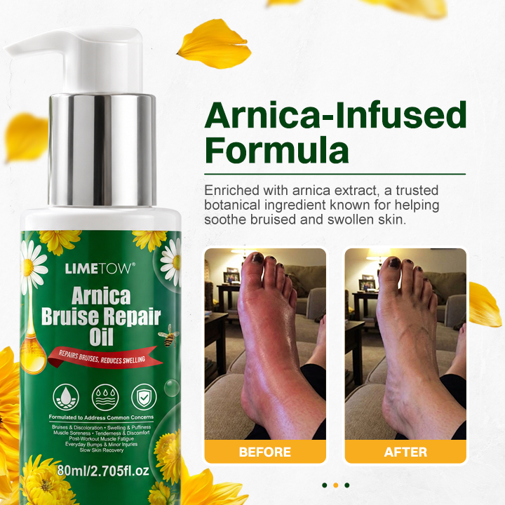 LIMETOW® Arnica Bruise Repair Oil