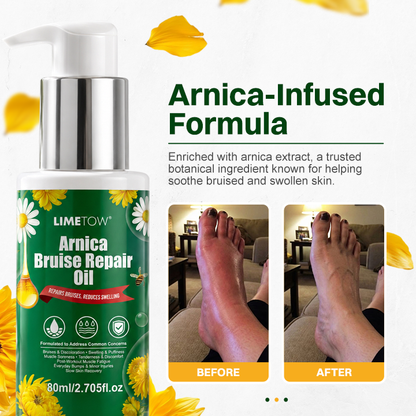 LIMETOW® Arnica Bruise Repair Oil
