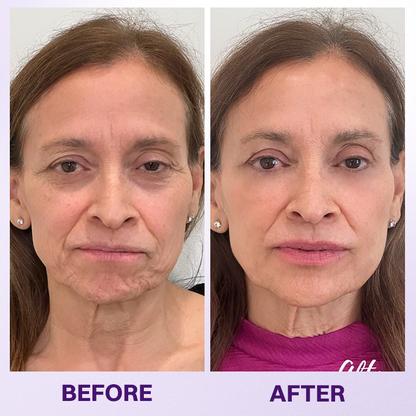 LIMETOW® INSTANT LIFT EYE GEL