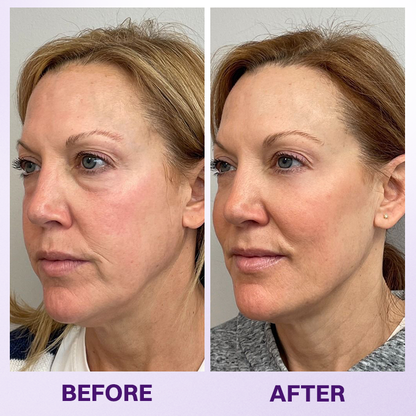 LIMETOW® INSTANT LIFT EYE GEL