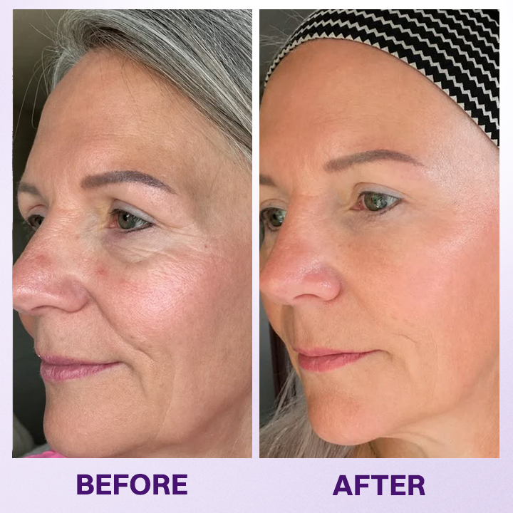 LIMETOW® INSTANT LIFT EYE GEL
